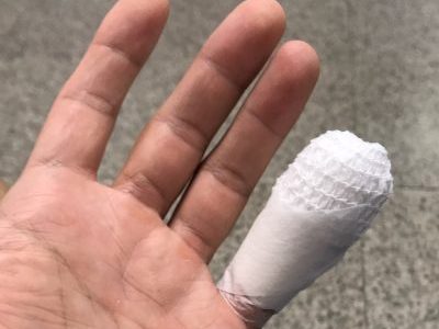 Little Fingers and the Body of&nbsp;Christ